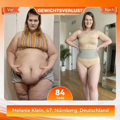 Offizieller Markenstore | ✅ 𝐏𝐀𝐔𝐑𝐀𝐉𝐔® 2026 Moringa & Berberin 4-in-1 Mikropartikel-Shaping & Fettverbrennungs-Shorts 🌹