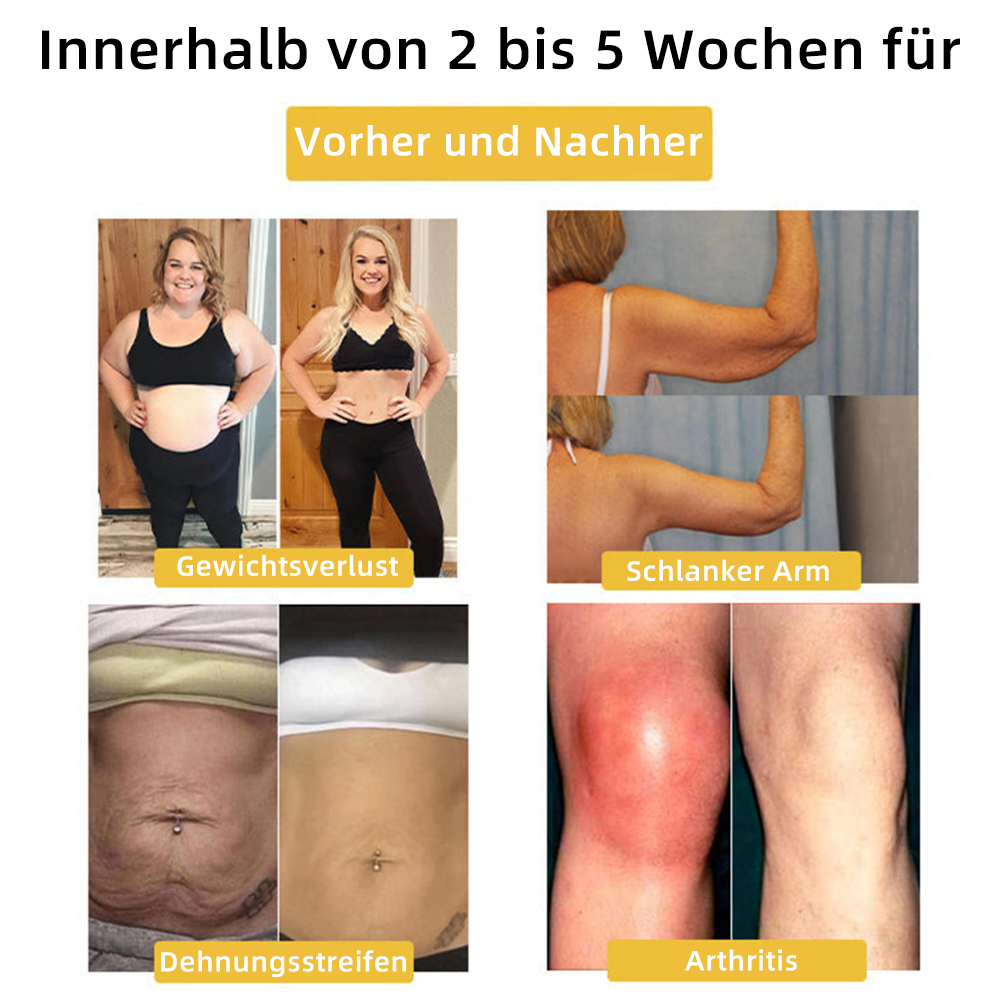 𝘾𝙕𝙏𝙄𝘾𝙇𝙀®Letzter Tag der Aktion — 50% RABATT🔥𝐌𝐨𝐢𝐬𝐬𝐚𝐧𝐢𝐭-𝐌𝐚𝐠𝐧𝐞𝐭𝐨𝐭𝐡𝐞𝐫𝐚𝐩𝐢𝐞-𝐃𝐢𝐚𝐦𝐚𝐧𝐭𝐫𝐢𝐧𝐠 🌹