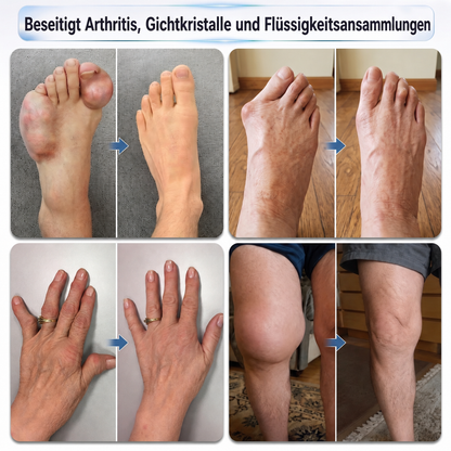 𝐈𝐅𝐌𝗔𝗚𝐈𝐂® 🧬 𝟎,𝟎𝟓 𝐦𝐦 𝐌𝐢𝐤𝐫𝐨𝐧𝐚𝐝𝐞𝐥-𝐑𝐨𝐥𝐥𝐞𝐫 𝐟ü𝐫 𝐊𝐧𝐨𝐜𝐡𝐞𝐧 & 𝐆𝐞𝐥𝐞𝐧𝐤𝐞🌿