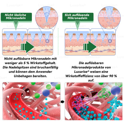 Offizieller Store |👨‍⚕️𝑳𝒖𝒙𝒂𝒓𝒊𝒔𝒆® Moringa & Berberine 10-IN-1 Fortgeschritten Nano Mikronadel-Pflaster(Einmal täglich, sichtbare Veränderungen in 7 Tagen) ✅ Fettleibigkeit, Diabetes, Schlafapnoe und Gelenkprobleme 💯