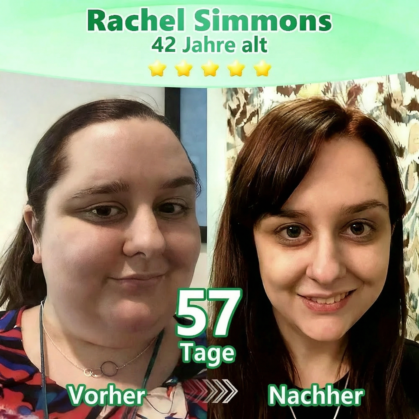 【Letzter Tag – 80 % Rabatt】 ✅ Florisma® Moringa · Berberin × NAD+ 10-in-1 Advanced Nano-Microneedle-Pflaster ✨ 7 Pflaster pro Packung · Vorrat für eine Woche🪴
