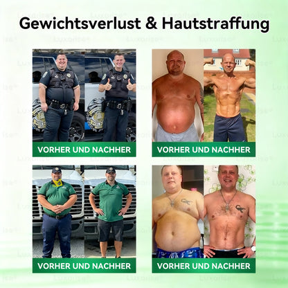 Offizieller Store |👨‍⚕️𝑳𝒖𝒙𝒂𝒓𝒊𝒔𝒆® Moringa & Berberine 10-IN-1 Fortgeschritten Nano Mikronadel-Pflaster(Einmal täglich, sichtbare Veränderungen in 7 Tagen) ✅ Fettleibigkeit, Diabetes, Schlafapnoe und Gelenkprobleme 💯
