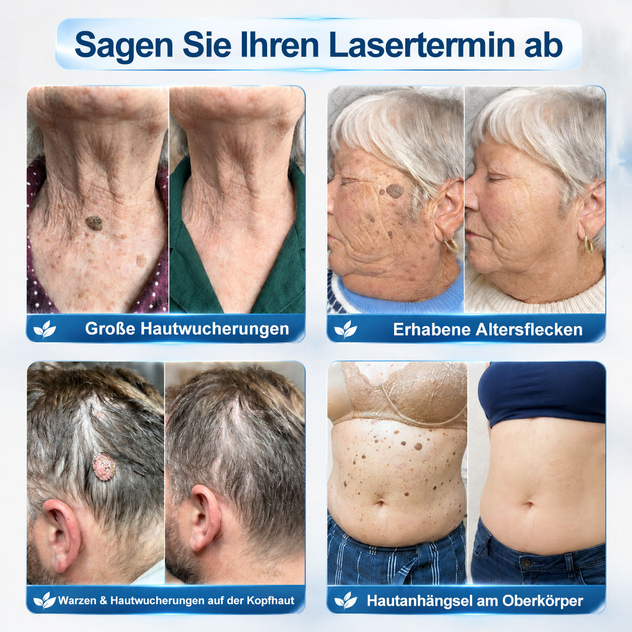 𝐎𝐟𝐟𝑖𝑧𝑖𝒆𝒍𝒍𝒆𝒓 𝑴𝒂𝗋𝗄𝖾𝗇𝘴𝘵𝘰𝘳𝘦|💦𝗣𝗶𝒄𝒅𝐨® 𝟕-𝑇𝖺𝗀𝗲 𝐹𝑙𝖾𝖼𝘬𝘦𝘯- & 𝑯𝖺𝒖𝗍𝖺𝗇𝗁ä𝘯𝘨𝘴𝘦𝘭-𝐸𝑛𝑡𝖿𝖾𝗋𝘯𝘦𝘳 (Schmerzfrei, Narbenfrei Rollerball)💦