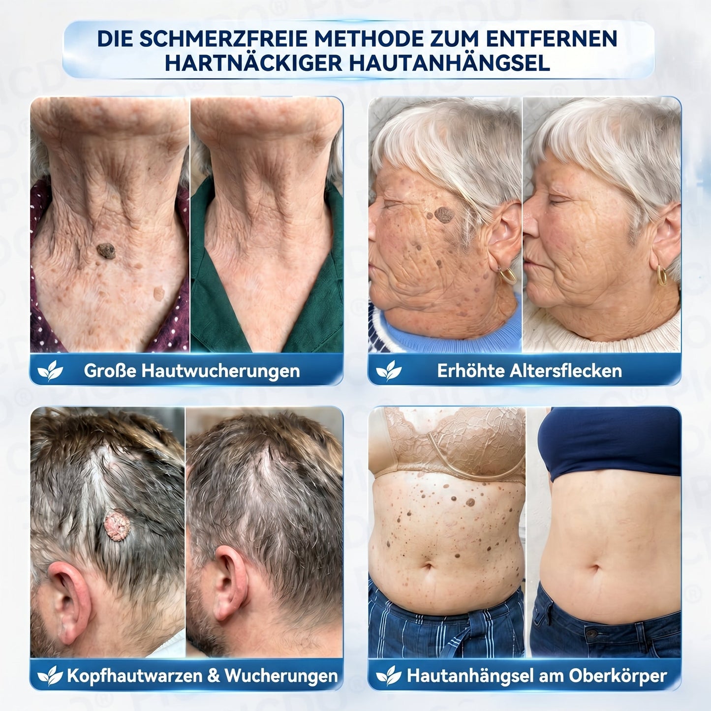 𝐏𝐢𝐜𝐝𝐨® 𝟕-𝐓𝐚𝐠𝐞 𝐇𝐚𝐮𝐭𝐚𝐧𝐡ä𝐧𝐠𝐬𝐞𝐥- & 𝐅𝐥𝐞𝐜𝐤𝐞𝐧-𝐄𝐧𝐭𝐟𝐞𝐫𝐧𝐮𝐧𝐠𝐬𝐜𝐫𝐞𝐦𝐞🖊️ (𝐒𝐜𝐡𝐦𝐞𝐫𝐳𝐟𝐫𝐞𝐢𝐞 𝐅𝐨𝐫𝐦𝐞𝐥 – 𝐨𝐡𝐧𝐞 𝐍𝐚𝐫𝐛𝐞𝐧) 🪴