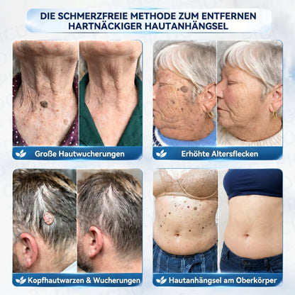 𝐏𝐢𝐜𝐝𝐨® 𝟕-𝐓𝐚𝐠𝐞 𝐇𝐚𝐮𝐭𝐚𝐧𝐡ä𝐧𝐠𝐬𝐞𝐥- & 𝐅𝐥𝐞𝐜𝐤𝐞𝐧-𝐄𝐧𝐭𝐟𝐞𝐫𝐧𝐮𝐧𝐠𝐬𝐜𝐫𝐞𝐦𝐞🖊️ (𝐒𝐜𝐡𝐦𝐞𝐫𝐳𝐟𝐫𝐞𝐢𝐞 𝐅𝐨𝐫𝐦𝐞𝐥 – 𝐨𝐡𝐧𝐞 𝐍𝐚𝐫𝐛𝐞𝐧) 🪴