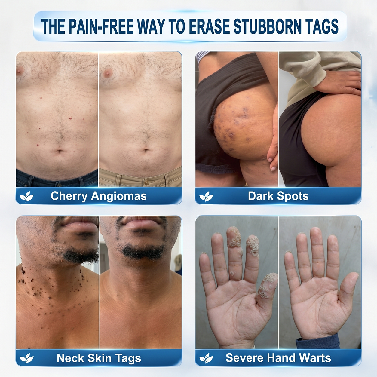 𝐎𝐟𝐟𝑖𝑧𝑖𝒆𝒍𝒍𝒆𝒓 𝑴𝒂𝗋𝗄𝖾𝗇𝘴𝘵𝘰𝘳𝘦|💦𝗣𝗶𝒄𝒅𝐨® 𝟕-𝑇𝖺𝗀𝗲 𝗘𝗻𝘵𝘧𝘦𝘳𝑛𝑒𝑟 𝑓ü𝘳 𝘏𝘢𝘶𝘁𝗮𝗻𝗵ä𝗇𝗀𝗌𝖾𝗅 & 𝐹𝑙𝑒𝐜𝐤𝖾𝗇 (schmerzfreier Rollerball ohne Narben)💦