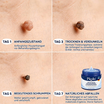 𝐏𝐢𝐜𝐝𝐨® 𝟕-𝐓𝐚𝐠𝐞 𝐇𝐚𝐮𝐭𝐚𝐧𝐡ä𝐧𝐠𝐬𝐞𝐥- & 𝐅𝐥𝐞𝐜𝐤𝐞𝐧-𝐄𝐧𝐭𝐟𝐞𝐫𝐧𝐮𝐧𝐠𝐬𝐜𝐫𝐞𝐦𝐞🖊️ (𝐒𝐜𝐡𝐦𝐞𝐫𝐳𝐟𝐫𝐞𝐢𝐞 𝐅𝐨𝐫𝐦𝐞𝐥 – 𝐨𝐡𝐧𝐞 𝐍𝐚𝐫𝐛𝐞𝐧) 🪴