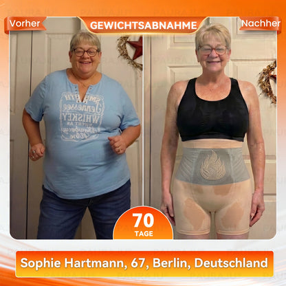 Offizieller Markenstore | ✨ 𝐏𝐀𝐔𝐑𝐀𝐉𝐔®✅ 2026 4-in-1 Mikropartikel-ShapingShorts🌵