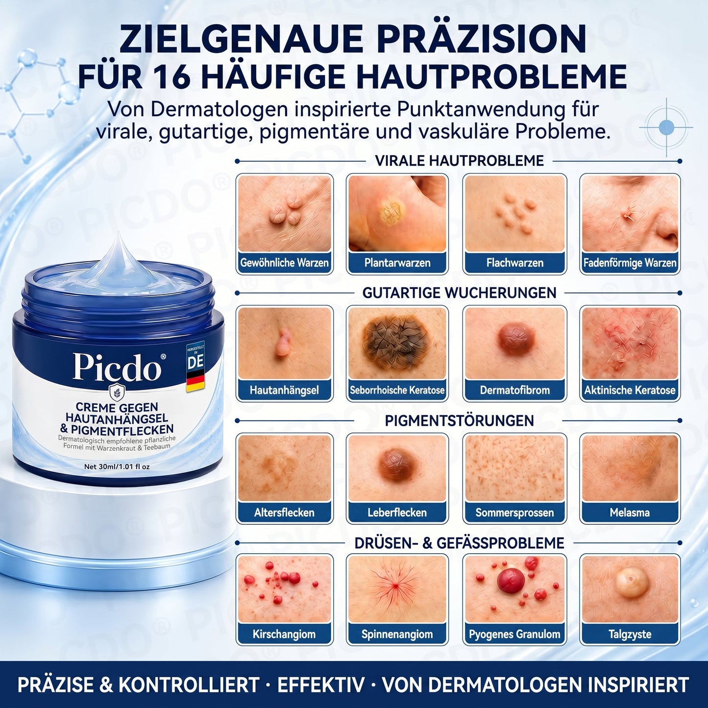 𝐏𝐢𝐜𝐝𝐨® 𝟕-𝐓𝐚𝐠𝐞 𝐇𝐚𝐮𝐭𝐚𝐧𝐡ä𝐧𝐠𝐬𝐞𝐥- & 𝐅𝐥𝐞𝐜𝐤𝐞𝐧-𝐄𝐧𝐭𝐟𝐞𝐫𝐧𝐮𝐧𝐠𝐬𝐜𝐫𝐞𝐦𝐞🖊️ (𝐒𝐜𝐡𝐦𝐞𝐫𝐳𝐟𝐫𝐞𝐢𝐞 𝐅𝐨𝐫𝐦𝐞𝐥 – 𝐨𝐡𝐧𝐞 𝐍𝐚𝐫𝐛𝐞𝐧) 🪴