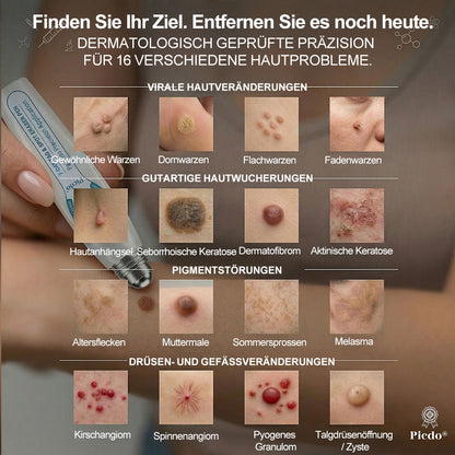 𝐎𝐟𝐟𝑖𝑧𝑖𝒆𝒍𝒍𝒆𝒓 𝑴𝒂𝗋𝗄𝖾𝗇𝘴𝘵𝘰𝘳𝘦|💦𝗣𝗶𝒄𝒅𝐨® 𝟕-𝑇𝖺𝗀𝗲 𝐹𝑙𝖾𝖼𝘬𝘦𝘯- & 𝑯𝖺𝒖𝗍𝖺𝗇𝗁ä𝘯𝘨𝘴𝘦𝘭-𝐸𝑛𝑡𝖿𝖾𝗋𝘯𝘦𝘳 (Schmerzfrei, Narbenfrei Rollerball)💦
