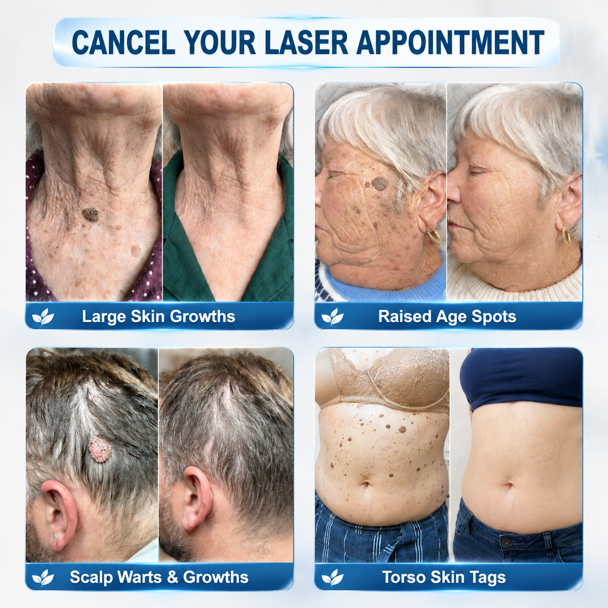 𝐎𝐟𝐟𝑖𝑧𝑖𝒆𝒍𝒍𝒆𝒓 𝑴𝒂𝗋𝗄𝖾𝗇𝘴𝘵𝘰𝘳𝘦|💦𝗣𝗶𝒄𝒅𝐨® 𝟕-𝑇𝖺𝗀𝗲 𝗘𝗻𝘵𝘧𝘦𝘳𝑛𝑒𝑟 𝑓ü𝘳 𝘏𝘢𝘶𝘁𝗮𝗻𝗵ä𝗇𝗀𝗌𝖾𝗅 & 𝐹𝑙𝑒𝐜𝐤𝖾𝗇 (schmerzfreier Rollerball ohne Narben)💦