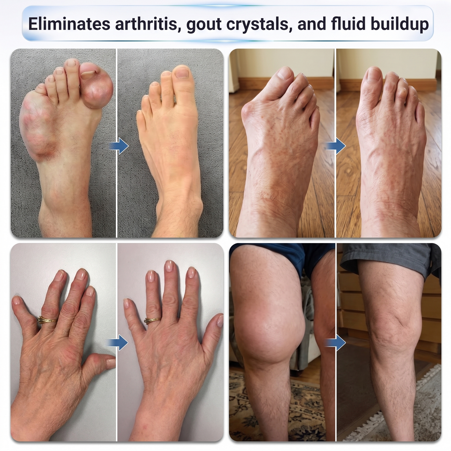 𝗜𝐅𝙈𝗔𝑮𝗜𝐂® 💠𝟬.𝟬𝟱𝗺𝗺 𝐌𝐢𝐜𝐫𝗼𝗻𝗲𝗲𝙙𝙡𝙚 𝑩𝒐𝒏𝒆 & 𝐉𝐨𝗶𝗻𝘁 𝗥𝗼𝗹𝗹𝒆𝙧🦴