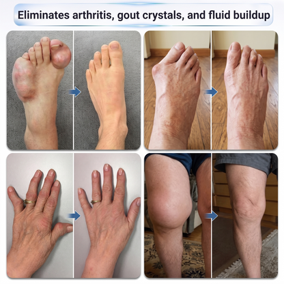 𝗜𝐅𝙈𝗔𝑮𝗜𝐂® 💠𝟬.𝟬𝟱𝗺𝗺 𝐌𝐢𝐜𝐫𝗼𝗻𝗲𝗲𝙙𝙡𝙚 𝑩𝒐𝒏𝒆 & 𝐉𝐨𝗶𝗻𝘁 𝗥𝗼𝗹𝗹𝒆𝙧🦴
