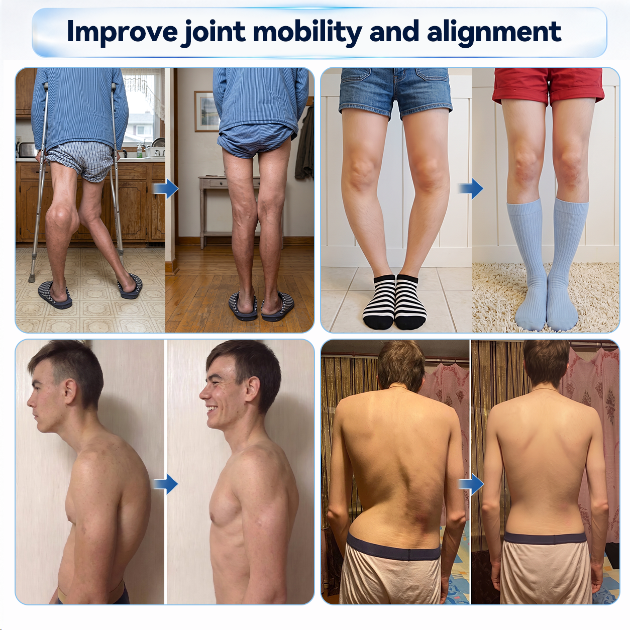 𝗜𝐅𝙈𝗔𝑮𝗜𝐂® 💠𝟬.𝟬𝟱𝗺𝗺 𝐌𝐢𝐜𝐫𝗼𝗻𝗲𝗲𝙙𝙡𝙚 𝑩𝒐𝒏𝒆 & 𝐉𝐨𝗶𝗻𝘁 𝗥𝗼𝗹𝗹𝒆𝙧🦴